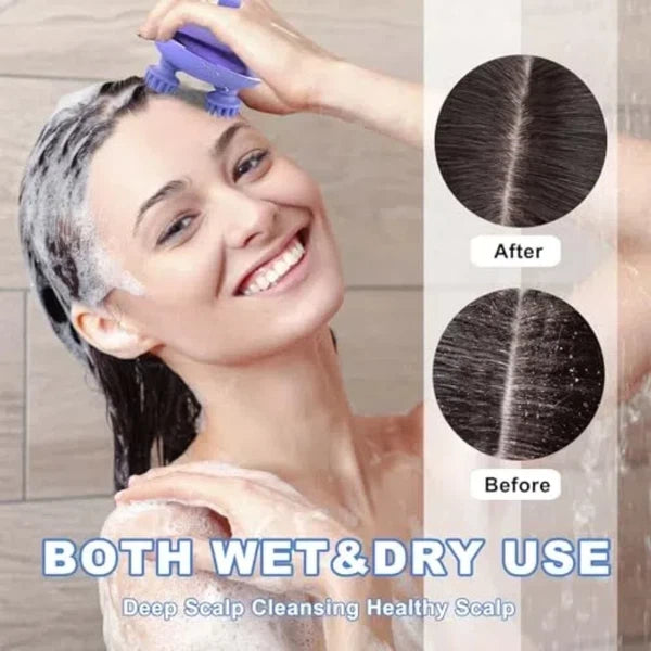 Scalp Massager Electric Waterproof Handheld, 3 Speeds, 8 Claws, Purple